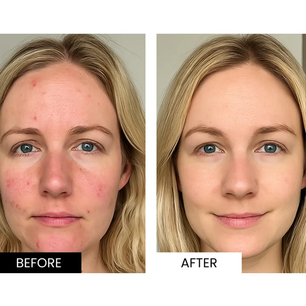 Sekoda LED Mask visible results 3