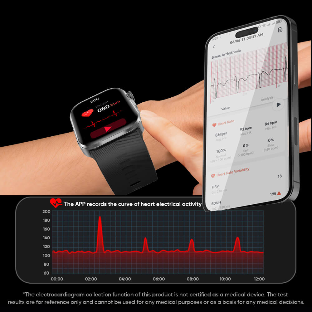 Clorant Smart Blood Pressure Smartwatch ECG AI cardiac analysis