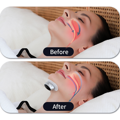 Before and after comparison of a facial treatment with a mivrass Smart Anti Snoring Device on a person's face.