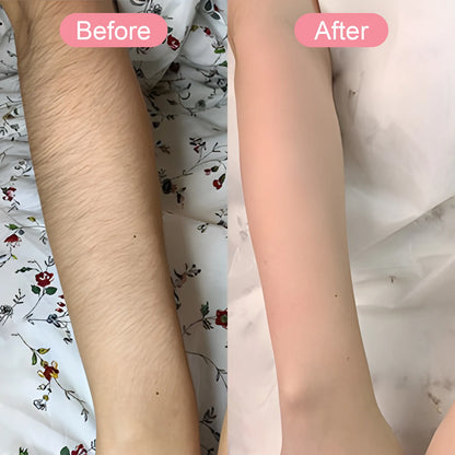 Sekoda Bikini Trimmer visible results 2