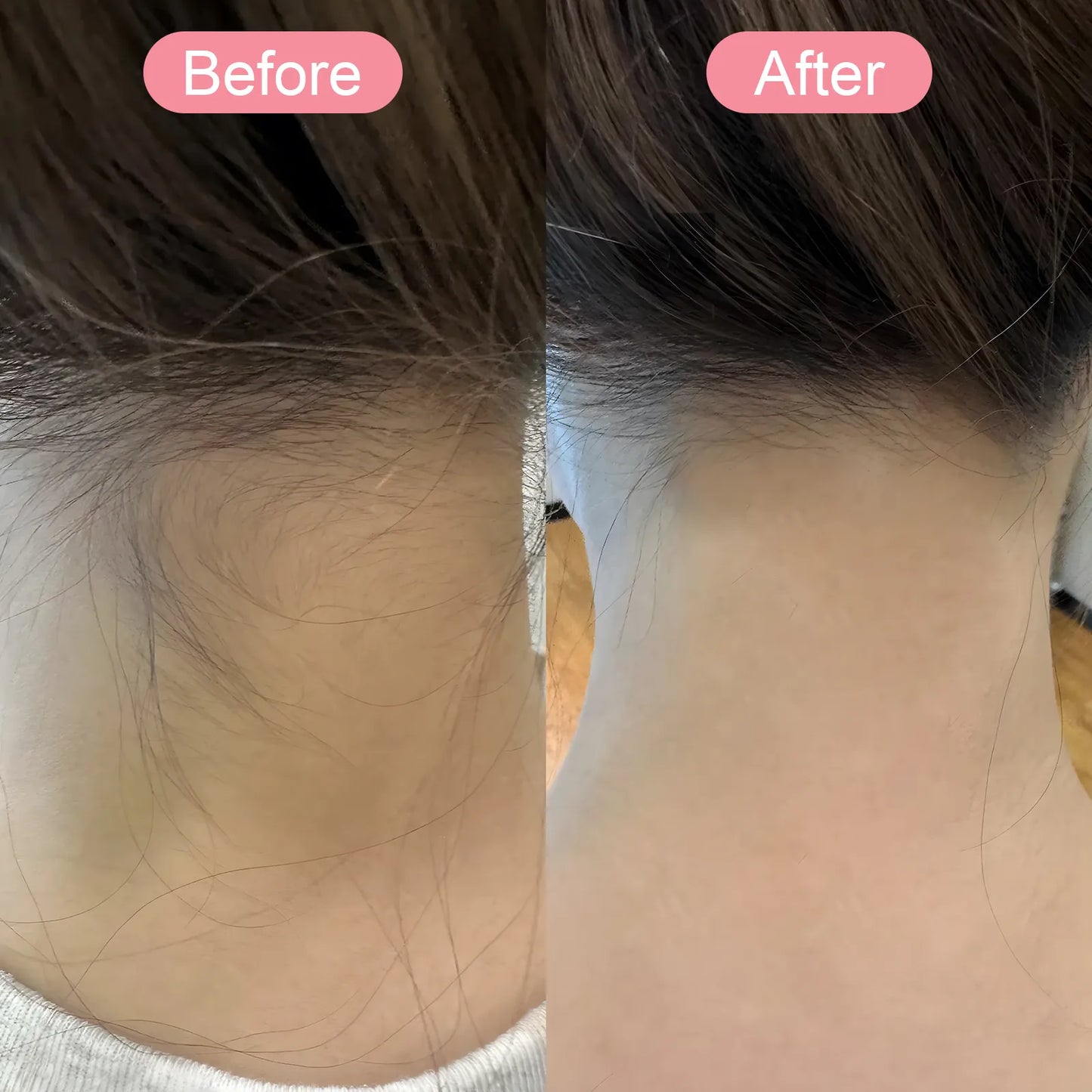 Sekoda Bikini Trimmer visible results 3