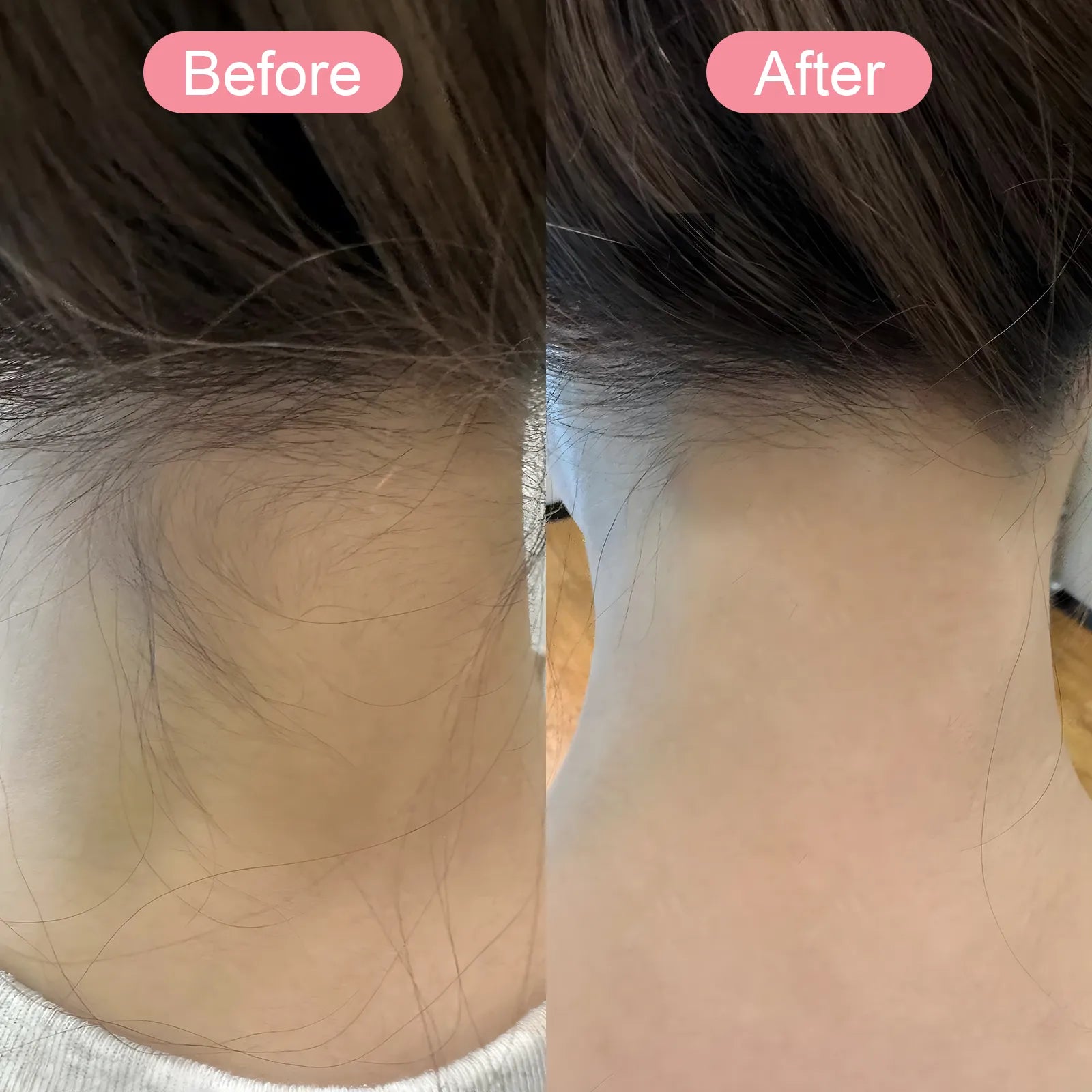 Sekoda Bikini Trimmer visible results 3