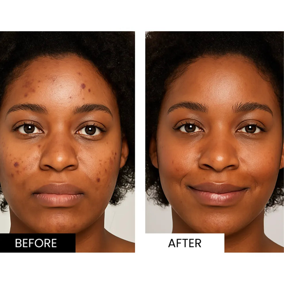 Sekoda LED Mask visible results 2