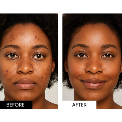 Sekoda LED Mask visible results 2